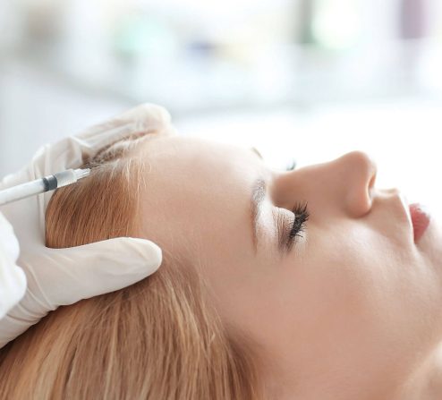 کاشت موی سر