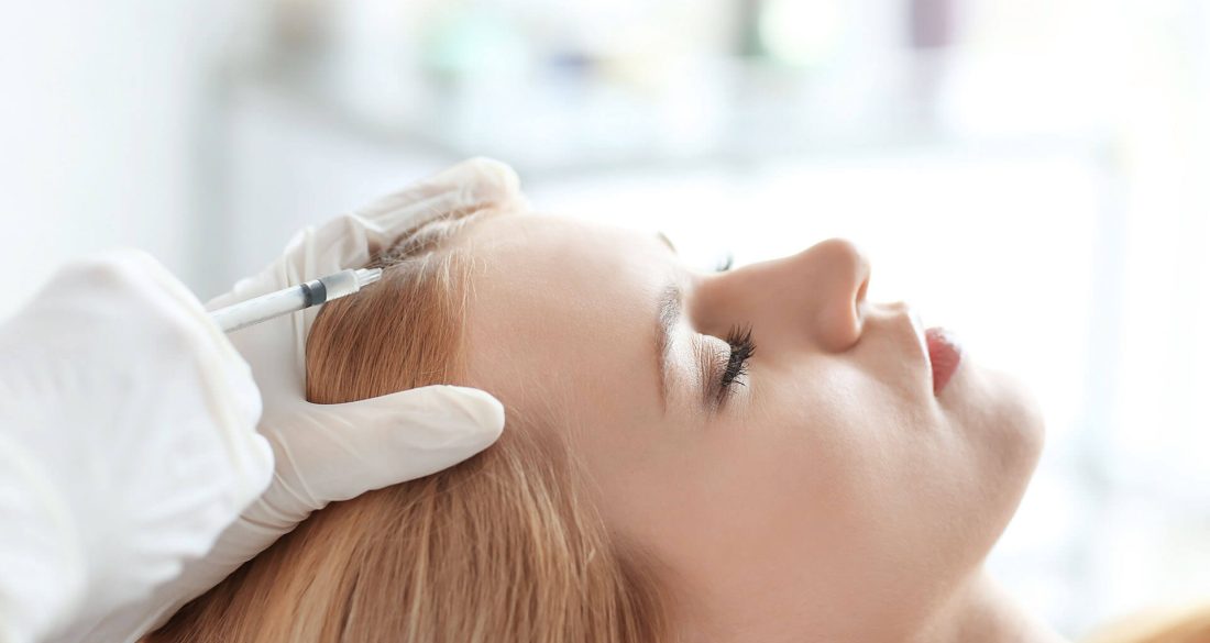 کاشت موی سر